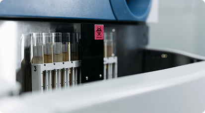 Análisis de muestras en laboratorio especializado